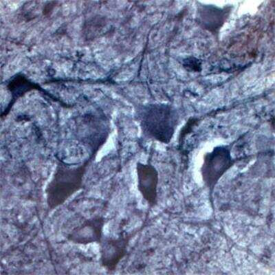 Immunohistochemistry Free-Floating: Choline Acetyltransferase/ChAT Antibody [NB110-89724]