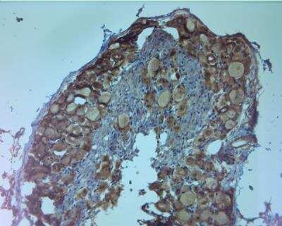 Immunohistochemistry-Paraffin: Choline Acetyltransferase/ChAT Antibody [NB110-89724]