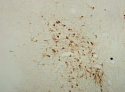 Immunohistochemistry-Paraffin: Choline Acetyltransferase/ChAT Antibody [NBP1-30052]