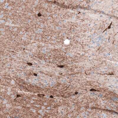 Immunohistochemistry-Paraffin: Choline Acetyltransferase/ChAT Antibody [NBP2-33530]