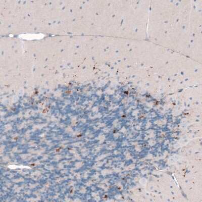 Immunohistochemistry-Paraffin: Choline Acetyltransferase/ChAT Antibody [NBP2-33530]