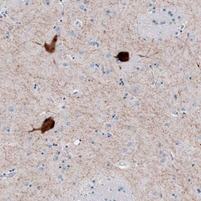 Immunohistochemistry-Paraffin: Choline Acetyltransferase/ChAT Antibody [NBP2-33530]