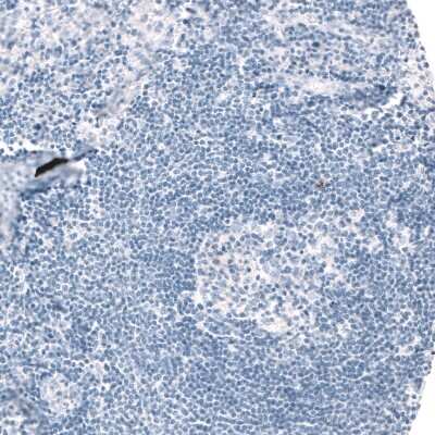 Immunohistochemistry-Paraffin: Choline Acetyltransferase/ChAT Antibody [NBP2-33530]