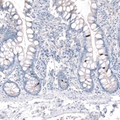 Immunohistochemistry-Paraffin: Choline Acetyltransferase/ChAT Antibody [NBP2-33530]