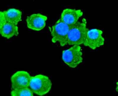 Immunocytochemistry/ Immunofluorescence: Choline Acetyltransferase/ChAT Antibody (JA67-11) [NBP2-66779]