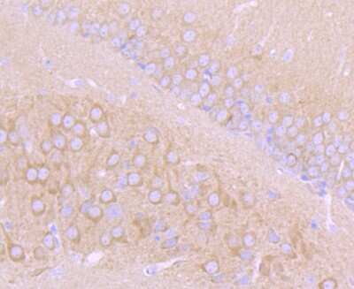 Immunohistochemistry-Paraffin: Choline Acetyltransferase/ChAT Antibody (JA67-11) [NBP2-66779]