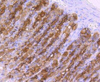 Immunohistochemistry-Paraffin: Choline Acetyltransferase/ChAT Antibody (JA67-11) [NBP2-66779]