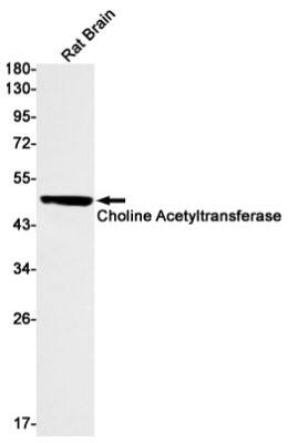 Western Blot: Choline Acetyltransferase/ChAT Antibody (S07-1G8) [NBP3-19603]