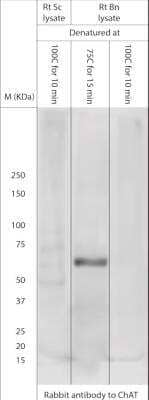 Western Blot: Choline Acetyltransferase/ChAT Antibody [NB110-89724]