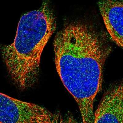 Immunocytochemistry/ Immunofluorescence: Choline Kinase beta Antibody [NBP1-85632]