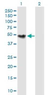 Western Blot: Choline Kinase beta Antibody [H00001120-B01P]