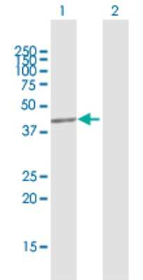 Western Blot: Choline Kinase beta Antibody [H00001120-D01P]