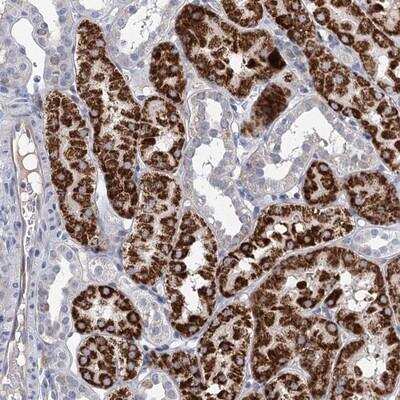 Immunohistochemistry: Choline dehydrogenase Antibody [NBP1-87508]