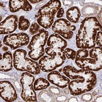 Immunohistochemistry: Choline dehydrogenase Antibody [NBP2-38842]