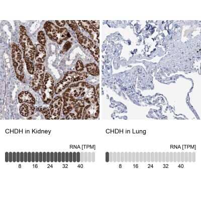 Immunohistochemistry-Paraffin: Choline dehydrogenase Antibody [NBP1-87508]