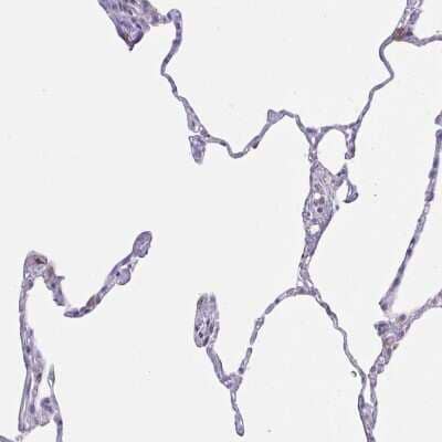 Immunohistochemistry-Paraffin: Choline dehydrogenase Antibody [NBP2-38842]