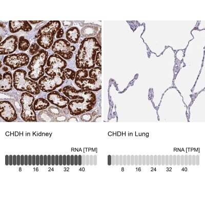 Immunohistochemistry-Paraffin: Choline dehydrogenase Antibody [NBP2-38842]
