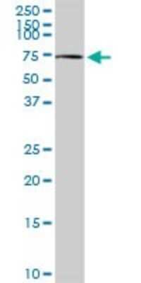 Western Blot: Choline dehydrogenase Antibody [H00055349-D01P]