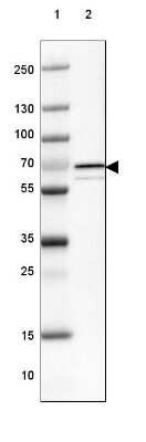 Western Blot: Choline dehydrogenase Antibody [NBP1-87508]