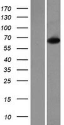 Western Blot: Choline dehydrogenase Overexpression Lysate [NBP2-06800]