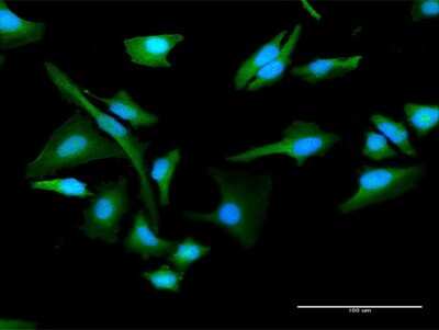 Immunocytochemistry/ Immunofluorescence: Choline kinase alpha Antibody [H00001119-D01P]