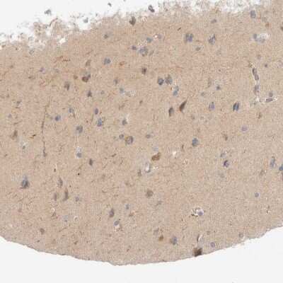 Immunohistochemistry-Paraffin: Choline kinase alpha Antibody [NBP1-85630]
