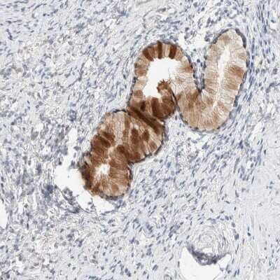 Immunohistochemistry-Paraffin: Choline kinase alpha Antibody [NBP1-85630]