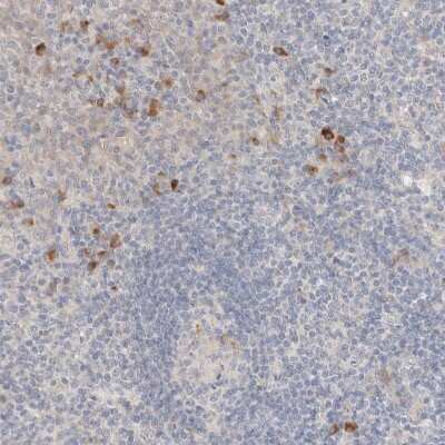 Immunohistochemistry-Paraffin: Choline kinase alpha Antibody [NBP1-85630]