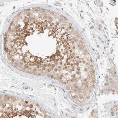 Immunohistochemistry-Paraffin: Choline kinase alpha Antibody [NBP1-85630]