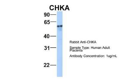 Western Blot: Choline kinase alpha Antibody [NBP1-56668]