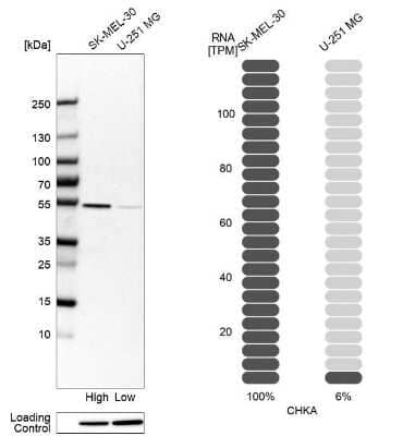 Western Blot: Choline kinase alpha Antibody [NBP1-85630]