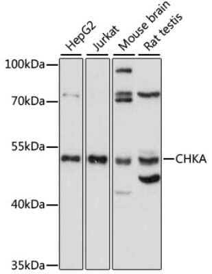 Western Blot: Choline kinase alpha AntibodyAzide and BSA Free [NBP2-92205]