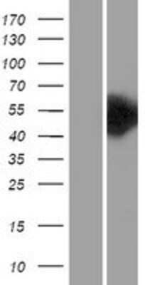 Western Blot: Choline kinase alpha Overexpression Lysate [NBL1-09157]