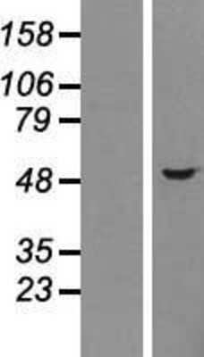 Western Blot: Choline kinase alpha Overexpression Lysate [NBP2-04484]