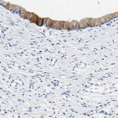 Immunohistochemistry-Paraffin: Chondroadherin Antibody [NBP1-87031]
