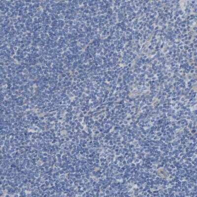 Immunohistochemistry-Paraffin: Chondroadherin Antibody [NBP1-87031]