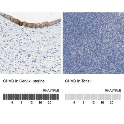 Immunohistochemistry-Paraffin: Chondroadherin Antibody [NBP1-87031]