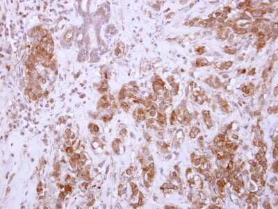 Immunohistochemistry-Paraffin: Chondroadherin Antibody [NBP2-15890]
