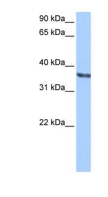 Western Blot: Chondroadherin Antibody [NBP1-58039]