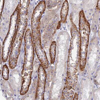 Immunohistochemistry-Paraffin: Chondroitin sulfate synthase 3 Antibody [NBP1-85626]