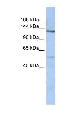 Western Blot: Chondroitin sulfate synthase 3 Antibody [NBP1-59673]