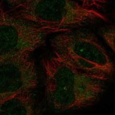 Immunocytochemistry/ Immunofluorescence: Chondrolectin Antibody [NBP3-17695]