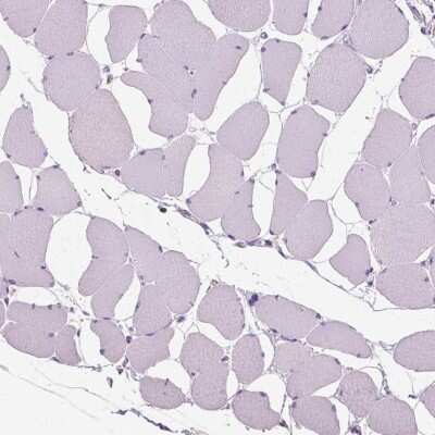 Immunohistochemistry-Paraffin: Chondrolectin Antibody [NBP1-86817]