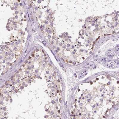 Immunohistochemistry-Paraffin: Chondrolectin Antibody [NBP1-86817]
