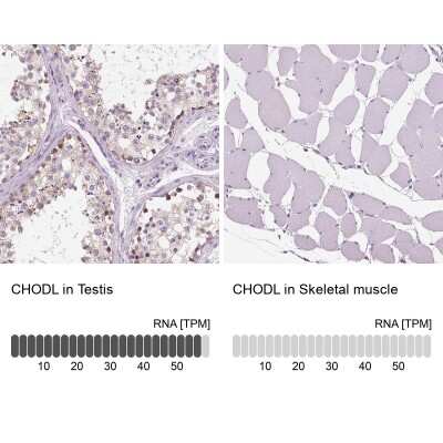 Immunohistochemistry-Paraffin: Chondrolectin Antibody [NBP1-86817]