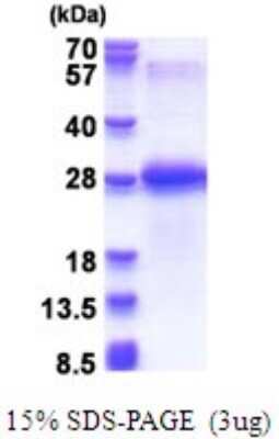 SDS-PAGE: Recombinant Human Chondrolectin His Protein [NBP2-51693]