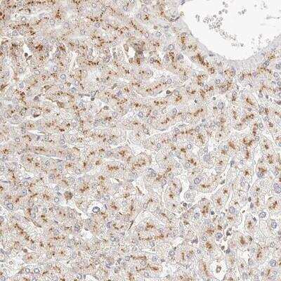 Immunohistochemistry-Paraffin: Chondromodulin-1/LECT1 Antibody [NBP1-84484]