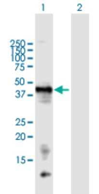 Western Blot: Chondromodulin-1/LECT1 Antibody [H00011061-B01P]