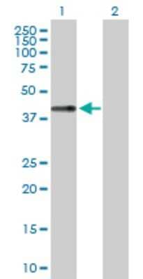 Western Blot: Chondromodulin-1/LECT1 Antibody [H00011061-D01P]