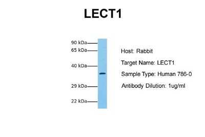 Western Blot: Chondromodulin-1/LECT1 Antibody [NBP1-59348]